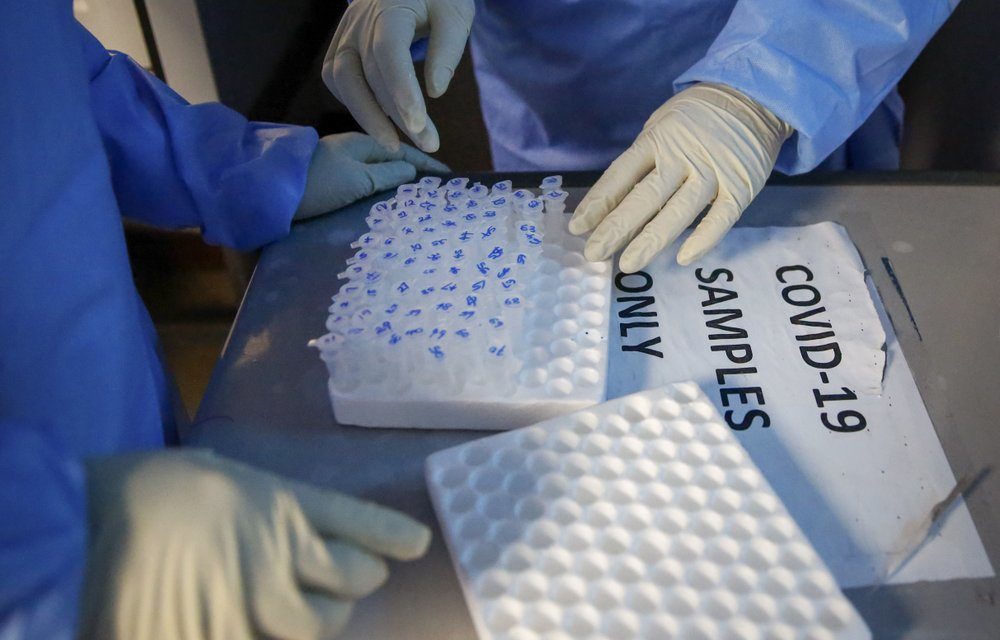 UNC Health Hits Milestone of 100,000 COVID-19 Tests, Prepares for Flu Season