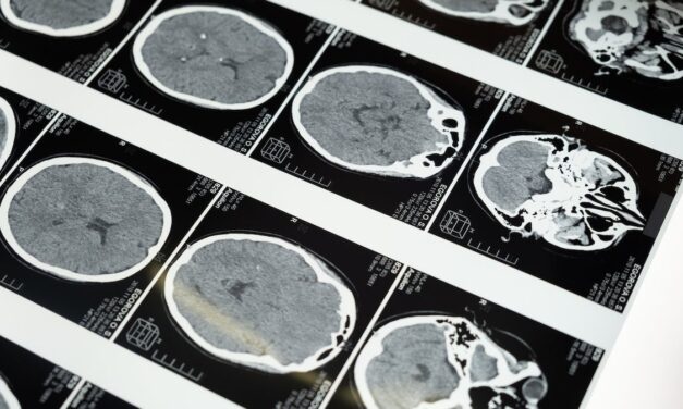 Exploring Your Creative Genius: Creativity and the Aging Brain