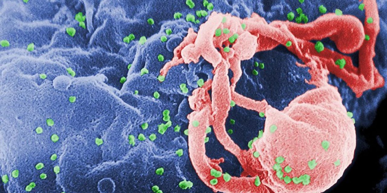 UNC Virologists Discover New Strategy to Treat HIV Infections