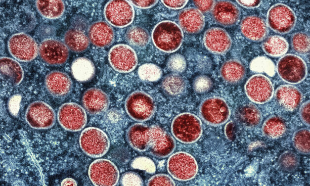 WHO Declares mpox Outbreaks in Africa a Global Health Emergency as a New Form of the Virus Spreads
