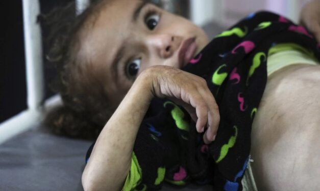 Gaza’s Main Hospital Is Overwhelmed With Children in Pain From Malnutrition