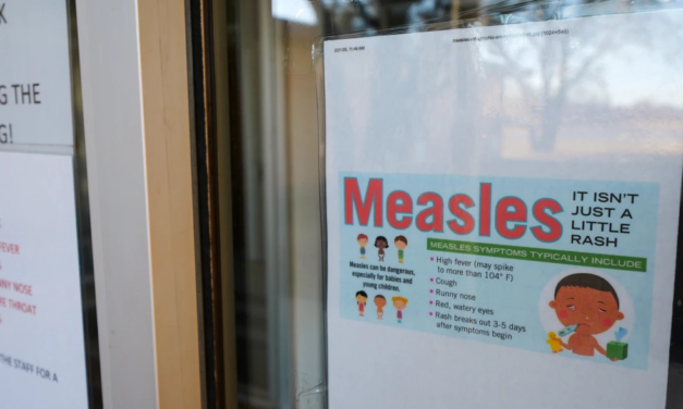 Confirmed Measles Case Reported at Chapel Hill Goodwill Store